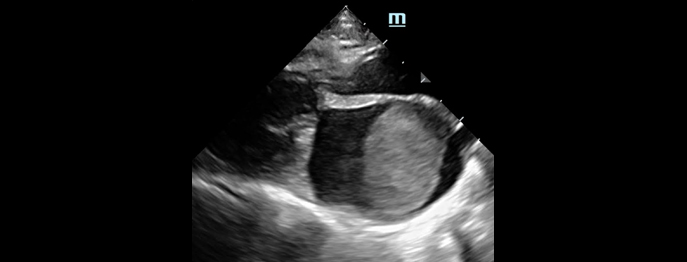https://www.vetinare.de/media/4c/3d/b0/1770037569/POCUS Thorax.jpg
